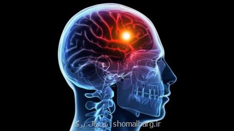 آیا درمانی برای سكته مغزی وجود دارد؟
